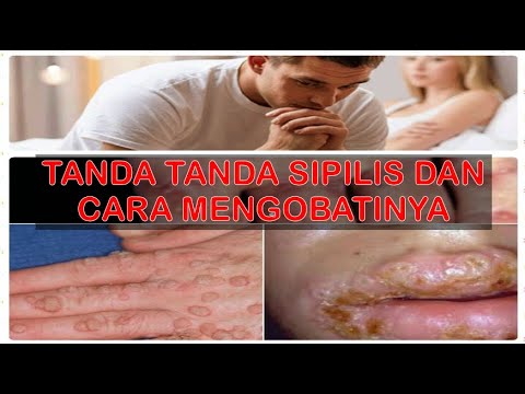tanda-tanda-sipilis-dan-cara-mengobatinya