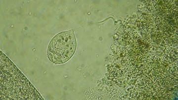 the ciliate Vorticella