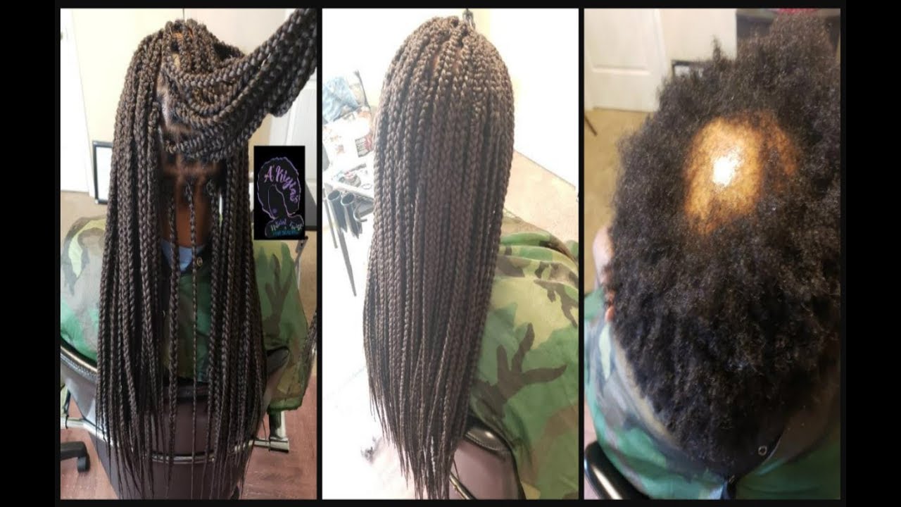 NO CORNROWS Single Crochet Braids ALOPECIA YouTube