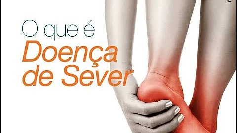 O que é osteocondrite de Calcaneo?