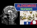 Current and Perspective Treatments for Alzheimer&#39;s Disease