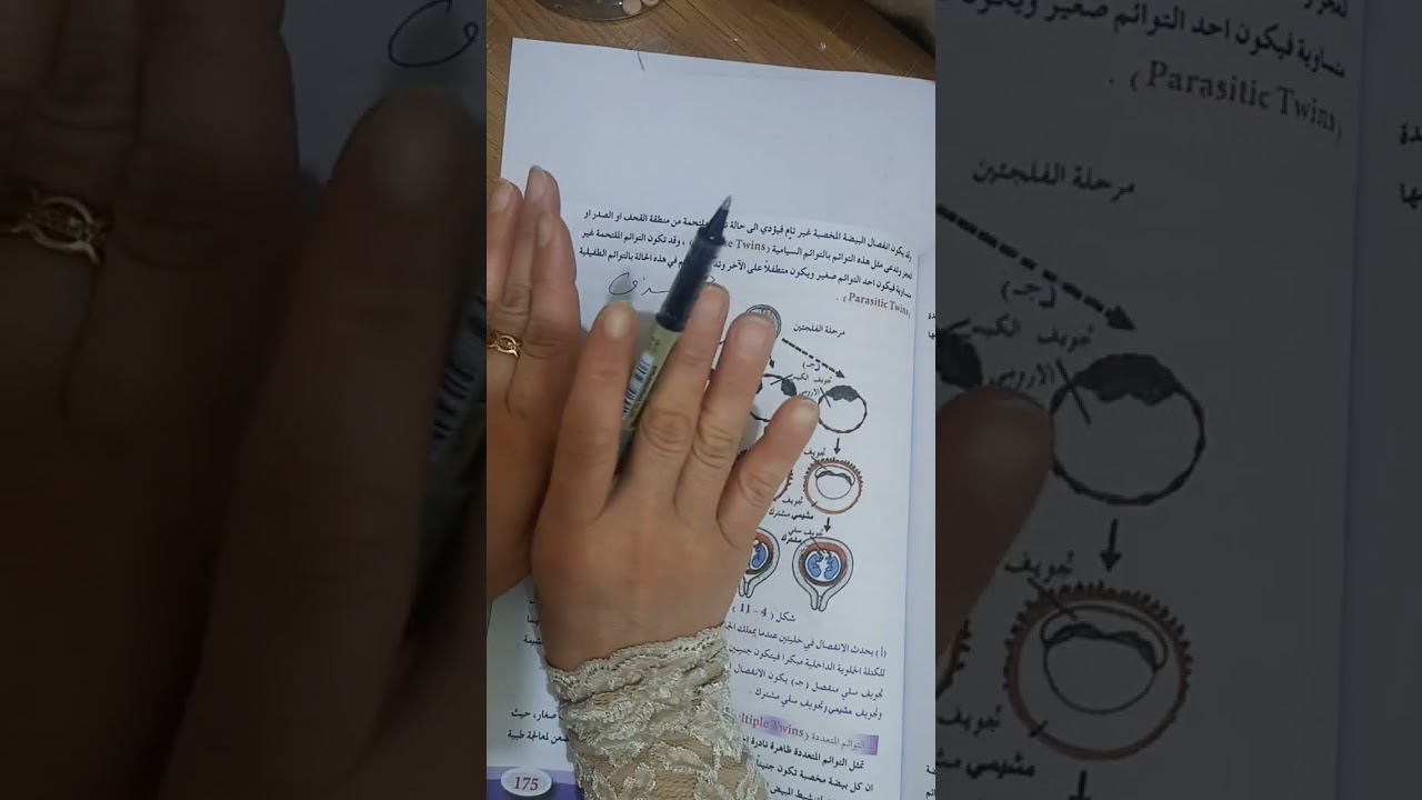 تعدد المواليد وتكوين التوائم