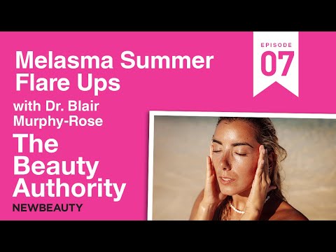 The Beauty Authority: Melasma Summer Flare-Ups