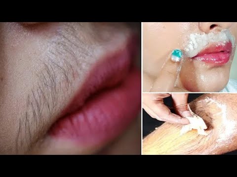 ضعيه على شعر وجهك وفوق الشفايف سيسقط من الجذور بلاألم يزيل الرؤوس السوداء البقع والتصبغات ناجحة100 