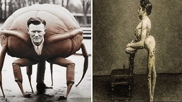 15 circusfreaks die echt hebben bestaan ​​in de geschiedenis