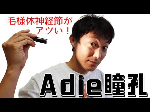 Adie瞳孔（毛様体神経節は神経の交差点）：瞳孔(Part.８)