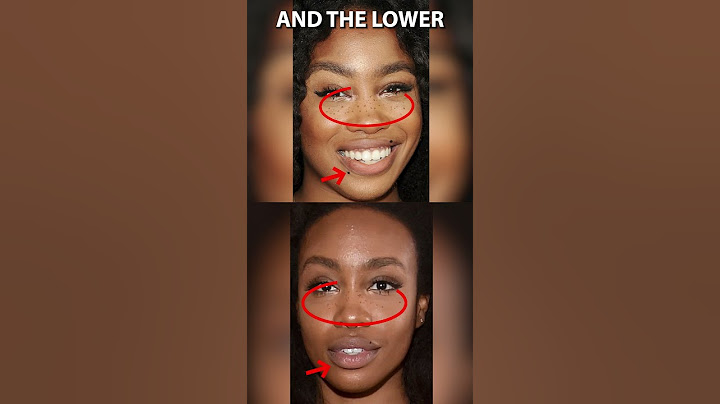 Did SZA have Fake Freckles?