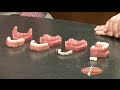 Mini Dental Implants, How They Work.