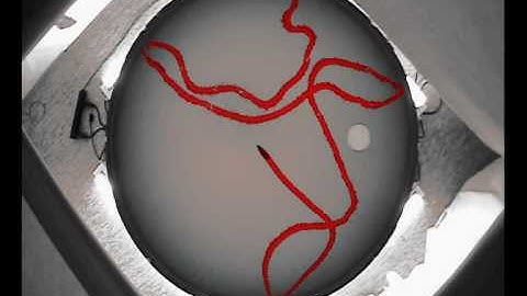 Mice with Alzheimer regain their memory