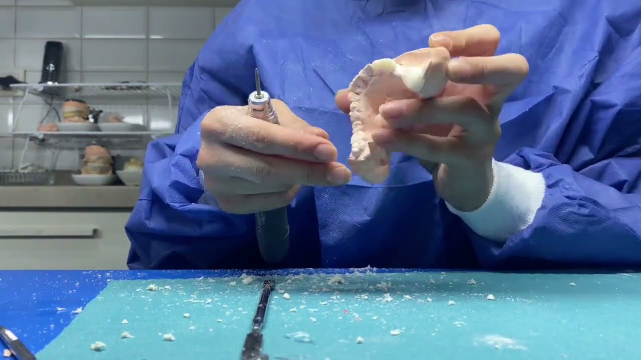 Diş teknikerinin yapabileceği GEÇİCİ DİŞ nasıl yapılır?