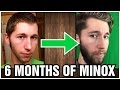 Minoxidil Beard - MONTHS 1-6