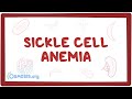 Sickle cell anemia - causes, symptoms, diagnosis, treatment & pathology