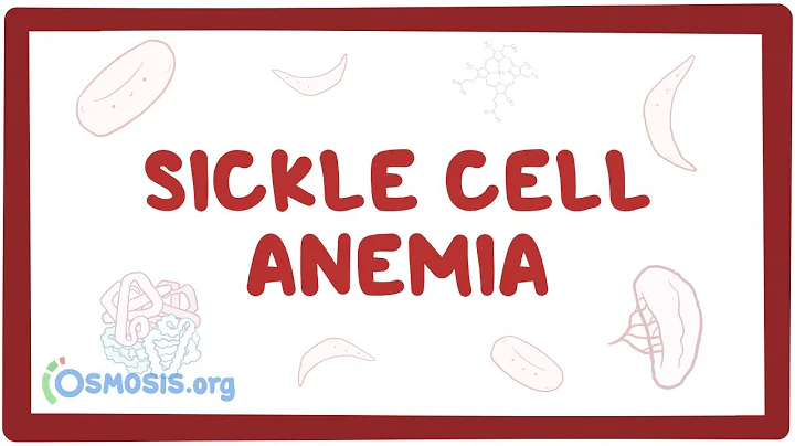 Sickle cell anemia - causes, symptoms, diagnosis, treatment & pathology - DayDayNews