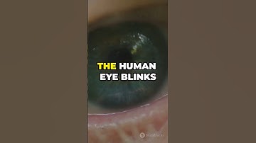 How Many Times Do You Blink a Day? The Astonishing Truth! 👀