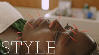 DOES FACIAL ACUPUNCTURE WORK? | We Tried It | The Sunday Times Style screenshot 5