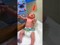 The Scary Newborn Test That Saves Lives 🤯
