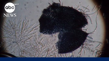 2 Chinese nationals charged with smuggling dangerous fungus into US