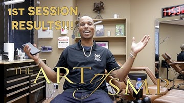 1st SESSION RESULTS!!!  SCALP MICROPIGMENTATION AT THE ART OF SMP