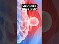 Pushing a hernia back into place (3D Animation)