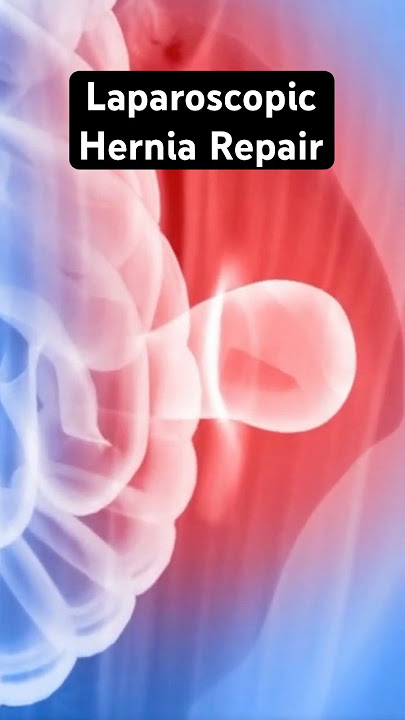 Pushing a hernia back into place (3D Animation)