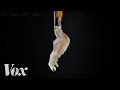 Prosthetic Technology and Innovations
