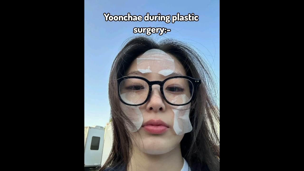 Yoonchae before and after plastic surgery #shorts #katseye #yoonchae #kpop