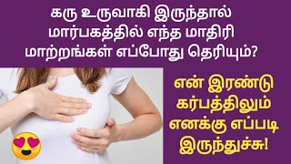 breast pain pregnancy symptoms in tamil | pregnancy symptoms in tamil | pregnancy test in tamil