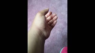 Famous Longer video of Twitching Hand lol Profile