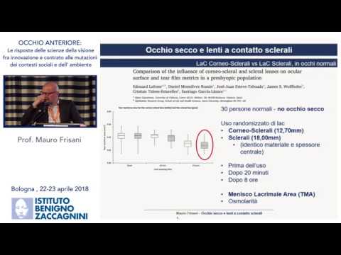 Video: Le lenti sclerali funzionano per l'occhio secco?