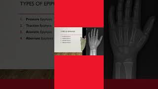 4️⃣ Types of epiphysis 🦴 #anatomy #anatomylectures #osteology #medicalstudent