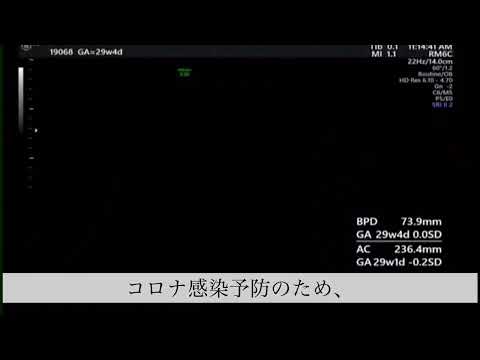 妊娠29週4日目のエコー