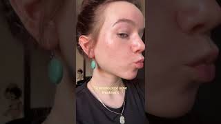 Breakouts Are Normal
