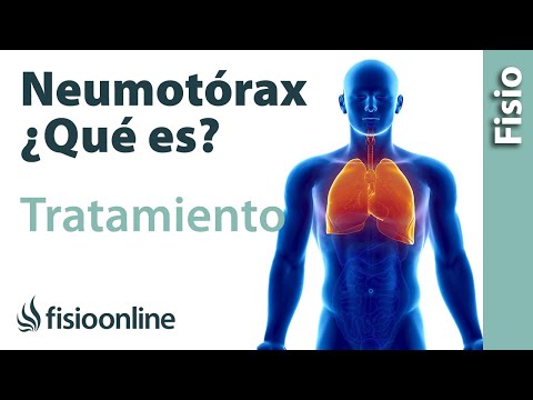 Vídeo: Neumotórax De Pulmón