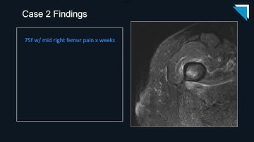 QA Forum Part 2: MSK | Free Radiology CME