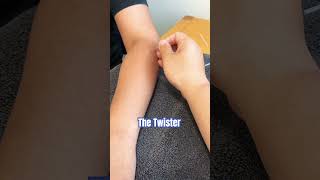 Discover Dry Needling Methods for ELBOW PAIN Relief