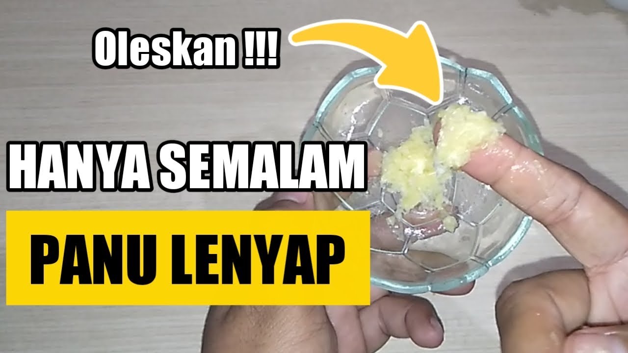 🔴TERBARU !!! OBAT PANU PALING AMPUH , CARA MENGOBATI PANU YANG SUDAH