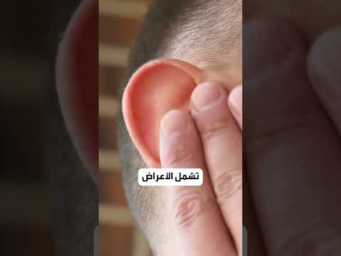 ثلاثة أمراض تصيبك بسبب حمامات السباحة