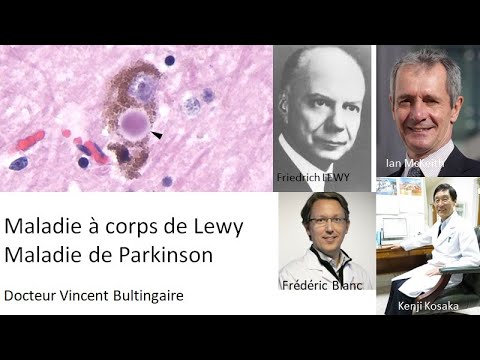 03 Maladie à corps de Lewy - YouTube