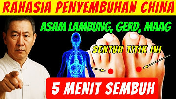 Asam Lambung, Maag Dan GERD Sembuh Total Tanpa Obat (Titik Akupresur Asam Lambung)