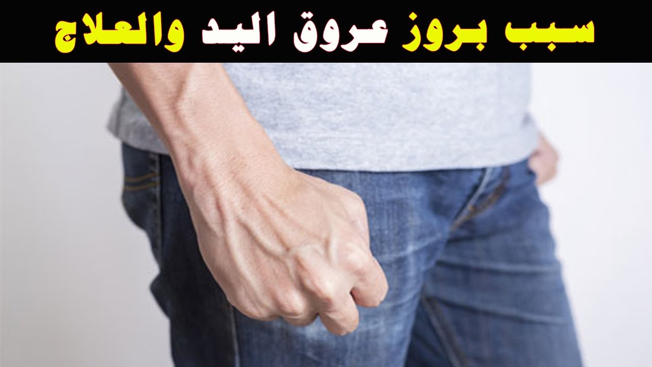 ما سبب ظهور عروق اليد الخضراء وطرق علاجها - YouTube