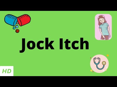 Jock Itch, Causes, Signs and Symptoms, Diagnosis and Treatment.