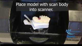 How to scan an implant case using Open Implants Scan Bodies by ADT