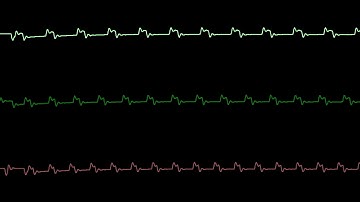 COMMODORE C64 SID - INCOHERENT NIGHTMARE (4) - by SASCHA ZEIDLER (LINUS) & FANTA / Oscilloscope View