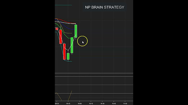 01022025 NO BRAIN 2025