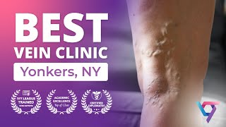 Best Vein Clinic in Yonkers, NY