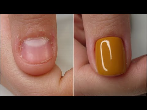 Βίντεο: 3 τρόποι για να βάψετε μικρά νύχια για να φαίνονται μεγαλύτερα