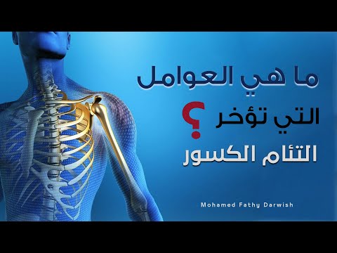 أهم العوامل التي تؤخر التئام الكسور