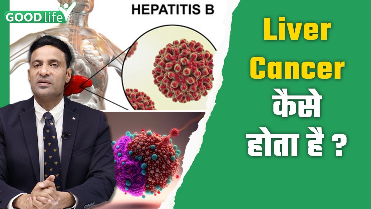 Liver Cancer Kyu Hota Hai लिवर कैंसर क्यों होता है Expert Advice