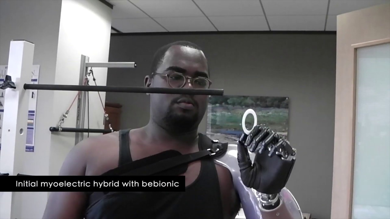 Lloyd Keith: Using His New Prosthetic Devices