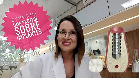 Quais são os tipos de prótese sobre implante?